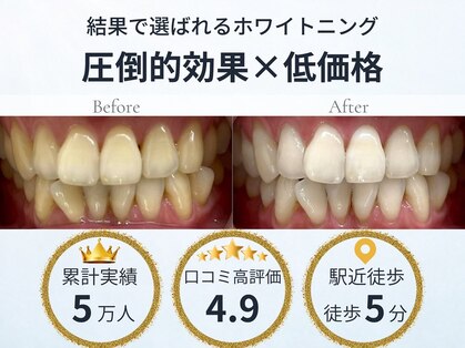 LBSホワイトニング 吉祥寺店の写真