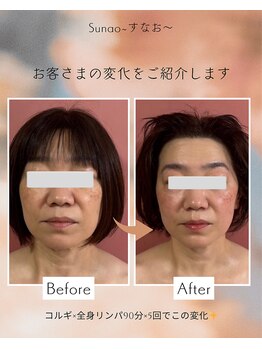 すなお 溝の口(Sunao)/【小顔コルギリンパ】50代お客様