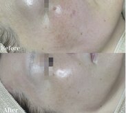 ロータス 大牟田店(Lotus.)