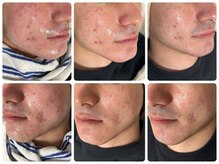 オルズ(Olu's)の雰囲気（正確なホームケアアドバイス×サロン施術で、最短で変化を提供◎）
