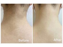 エアリアル 中津店/手の届かないうなじの毛