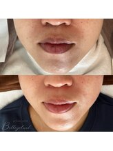 ベルアイラッシュ(Belleyelash)/【フェイシャルワックス】