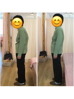 平川鍼灸接骨院 小堀院/猫背矯正