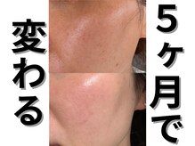 モニ 福岡(Moni)の雰囲気（ハーブピーリング でくすみシミケア）
