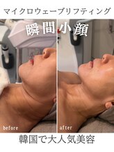 リリー(LILY)/韓国美容　LILY　