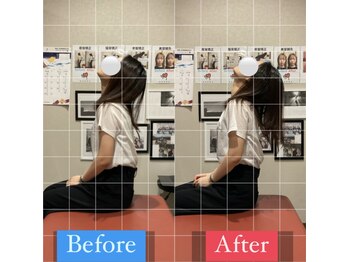 ナオル整体 宮崎院(NAORU整体)/20代女性施術事例【肩こり改善】