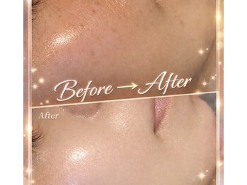 ビジュー(BIJOU)/