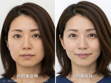 小顔矯正の美容整体サロン ソレイユ 神戸三宮(Soleil)