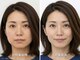 小顔矯正の美容整体サロン ソレイユ 神戸三宮(Soleil)の写真