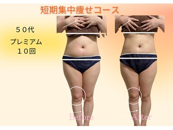 ヨサパーク リボーン(YOSA PARK Reborn)/劇的ビフォーアフター/痩身駒込