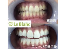 ルブラン 奈良店(Le Blanc)/毎月先着15名様限定 フリーパス