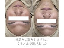 ミーミドットアイ(Mi-mi.i)/匠のフェイシャルマッサージ☆