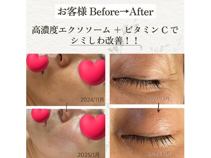 ベル(bel)の写真