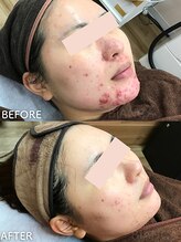 ビアンカ/お客様のお声