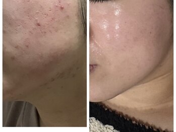 トータルビューティ リライフ(Total beauty Relife)/韓国肌管理