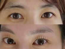 ウピ(UPi!)の雰囲気（目のゆるみ、しわも同時にケアしていきます。）
