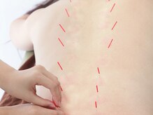 げんき堂整骨院 ウイングタウン岡崎の雰囲気（一人一人のお悩みに合わせてアプローチするオーダーメイド施術！）