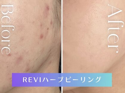 エレマヴィ(ele mavie)の写真