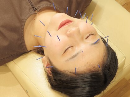 江古田りんく鍼灸整骨院の写真