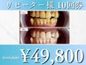【リピーター様】お得に通えるホワイトニング10回クーポン#ホワイトニング