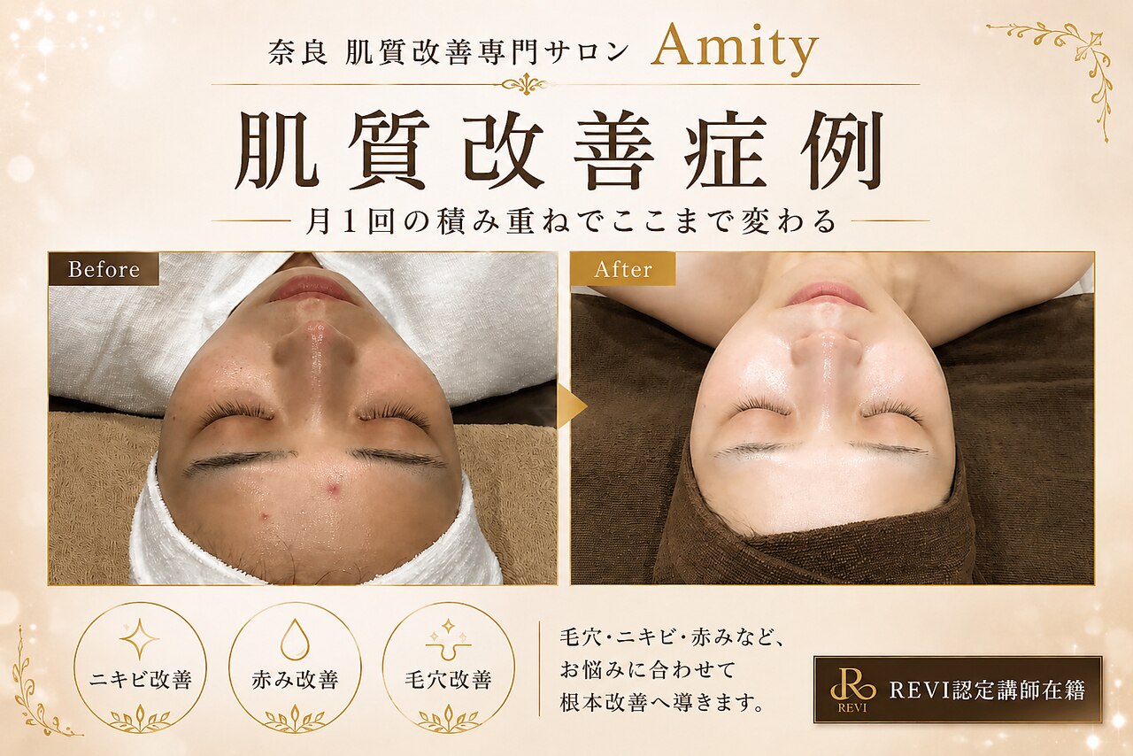 エスアール アミティ(SR Amity)｜ホットペッパービューティー