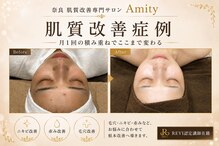 エスアール アミティ(SR Amity)