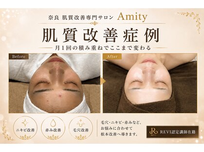 エスアール アミティ(SR Amity)の写真