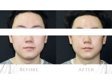 シェリール(CHIRIEUR)の雰囲気（メンズの毛穴詰まり、開き、黒ずみ改善）