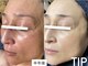 ソリッジ肌管理室の写真/シミケアと美白で輝く肌へ！ハーブピーリングで毛穴改善とくすみ改善を叶えるヘッドスパ付きの贅沢時間♪