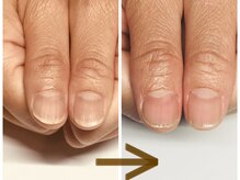 リ エコ(Ri:ECO)の雰囲気（施術例　お一人お一人に適した施術で「なりたい」に導きます！）