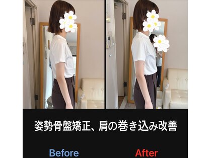 美容矯正サロン レレポノ(LELEPONO)の写真