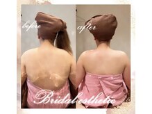 デジール(DESIR)/ブライダル痩身☆結果は倍出し！