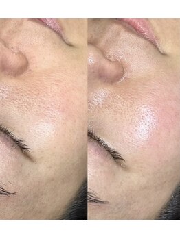 ハイク バイ ジェン(HIKE by gen.)/ フェイシャルワックス