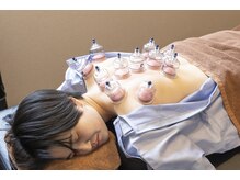 ラックス鍼灸 整体院(Lachs鍼灸 整体院)/カッピング