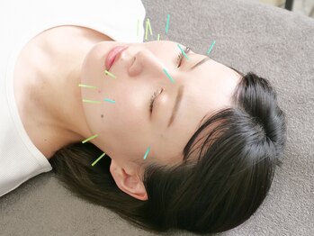 ラフテル鍼灸整骨院/美容鍼ライトコース♪