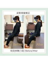 ゆめいろ整体院/姿勢骨盤矯正Before/After