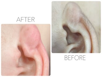 アイラッシュサロン ウェリナ 名古屋(Welina)/耳ツボジュエリー前に産毛Wax!