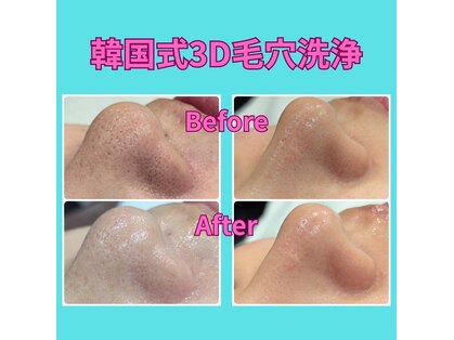 エン(en.)の写真