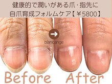 ネイルサロン ブランアンジュ(Blanc Ange)の雰囲気(元々の爪が…と諦めている方も当店のケア施術をお試しください!)