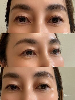 シューナランド(schoner Rand)/ラッシュリフト