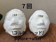 ポラリス(Polaris)/コルギ7回 Before/After