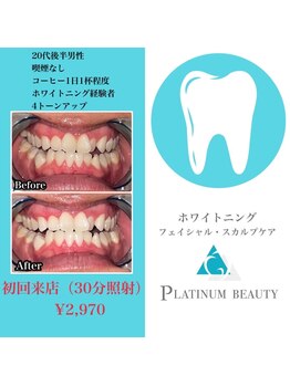 プラチナムビューティ 渋谷店(PLATINUM Beauty)/セルフホワイトニング