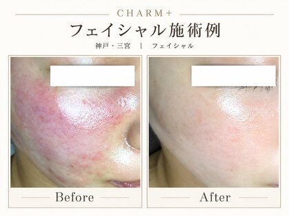 チャームプラス(CHARM+)の写真