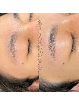 リンクス(links)/ワックス脱毛、メンズ