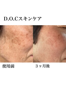 トキイロ 高宮(tokiiro)/高機能化粧品でシミケアを♪