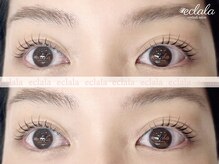 エクララ(eclala)/まつげパーマ