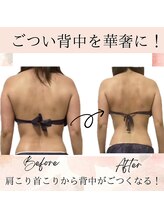 サロン ド ボーテ ラーンジュ 岐阜店(salon de beaut'e L'ange)/ハイパ-ナイフEX2ダイエット痩身