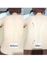 リリアン 長岡店(lirien)/凝り張り解消でメリハリボディ◆