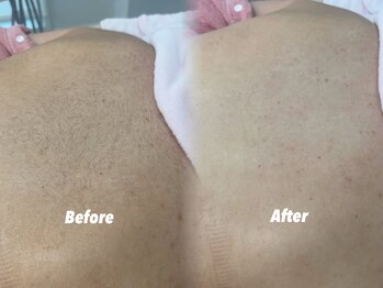 クイーン 渋谷店(QUEEN)/背中の毛大丈夫そう？