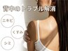 9月限定！【背中ケア】夏本番♪ソフトピーリング×クライオセラピー